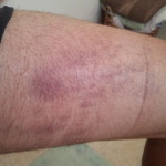 The Damage Done